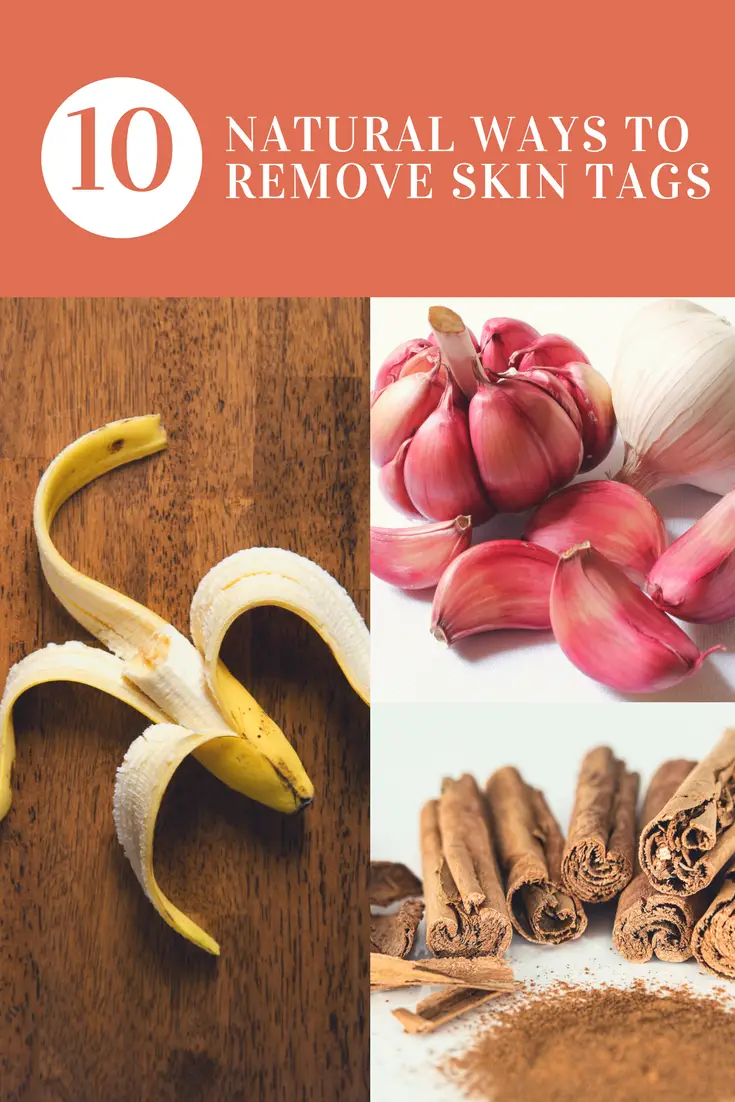 How to Remove Skin Tags Naturally & Safely – Happy Body Formula