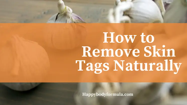 How to Remove Skin Tags Naturally & Safely - Happy Body Formula